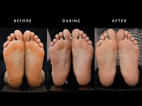 Foot Peel Mask